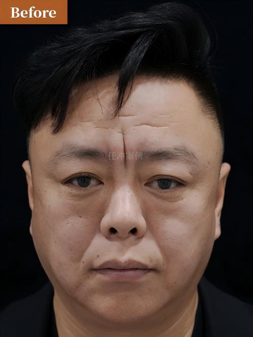康泰24小时在线套医保微信能用吗怎么弄？官方解答来了